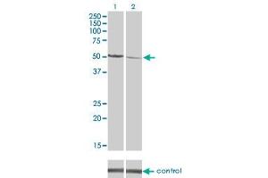 Image no. 1 for anti-Calcium/calmodulin-Dependent Protein Kinase II delta (CAMK2D) (AA 301-410) antibody (ABIN513980)