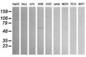Image no. 1 for anti-Aldehyde Dehydrogenase 1 Family, Member A3 (ALDH1A3) (AA 1-100), (AA 413-512) antibody (ABIN1490536)