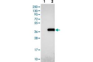 Image no. 2 for anti-Nudix (Nucleoside Diphosphate Linked Moiety X)-Type Motif 22 (NUDT22) antibody (ABIN5584839)