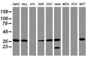 Image no. 2 for anti-Apurinic/Apyrimidinic Endonuclease 1 (APEX1) (AA 1-242) antibody (ABIN1490625)