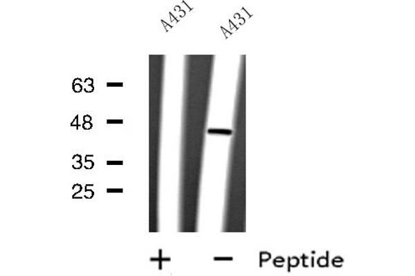 anti-Cylicin, Basic Protein of Sperm Head Cytoskeleton 2 (CYLC2) (C-Term) antibody