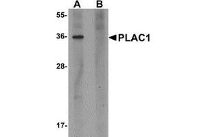 Image no. 1 for anti-Placenta-Specific 1 (PLAC1) (C-Term) antibody (ABIN783753)