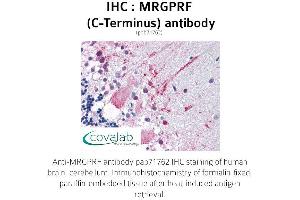 Image no. 1 for anti-MAS-Related GPR, Member F (Mrgprf) (C-Term), (Cytoplasmic Domain) antibody (ABIN1737069)