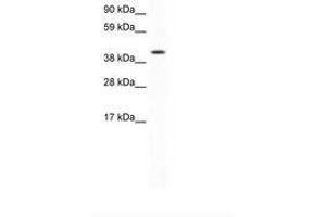 Image no. 1 for anti-Forkhead Box F1 (FOXF1) (AA 276-325) antibody (ABIN202323)