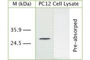 Image no. 1 for anti-DNA-Damage Regulated Autophagy Modulator 1 (DRAM1) (AA 160-210) antibody (ABIN350294)