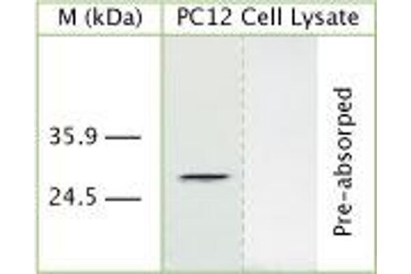 anti-DNA-Damage Regulated Autophagy Modulator 1 (DRAM1) (AA 160-210) antibody