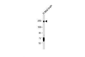 Image no. 2 for anti-L1 Cell Adhesion Molecule (L1CAM) (AA 1154-1182), (C-Term) antibody (ABIN5535974)