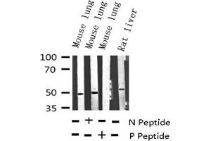 Image no. 3 for anti-Vasodilator-Stimulated phosphoprotein (VASP) (pSer157) antibody (ABIN6256156)