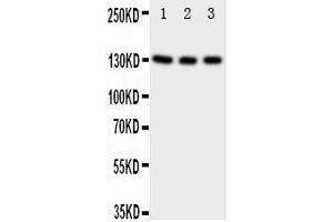 Image no. 1 for anti-Neurotrophic tyrosine Kinase, Receptor, Type 3 (NTRK3) (AA 172-186), (N-Term) antibody (ABIN3042961)