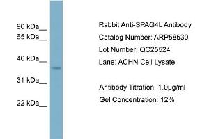 WB Suggested Anti-SPAG4L  Antibody Titration: 0.