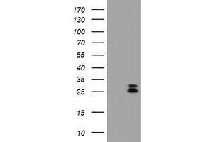 Image no. 5 for anti-Cytidine Monophosphate (UMP-CMP) Kinase 1, Cytosolic (CMPK1) antibody (ABIN1497546)