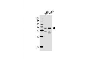 Image no. 1 for anti-Nuclear Factor I/C (CCAAT-Binding Transcription Factor) (NFIC) (AA 180-208) antibody (ABIN5537206)