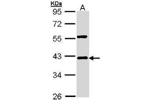 Image no. 2 for anti-Nuclear Factor of kappa Light Polypeptide Gene Enhancer in B-Cells Inhibitor, alpha (NFKBIA) (Center) antibody (ABIN2856763)