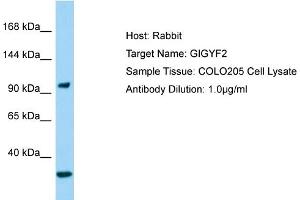 anti-GRB10 Interacting GYF Protein 2 (GIGYF2) (N-Term) antibody