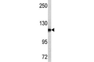 Image no. 1 for anti-Aminopeptidase Puromycin Sensitive (NPEPPS) (AA 709-737) antibody (ABIN3029923)