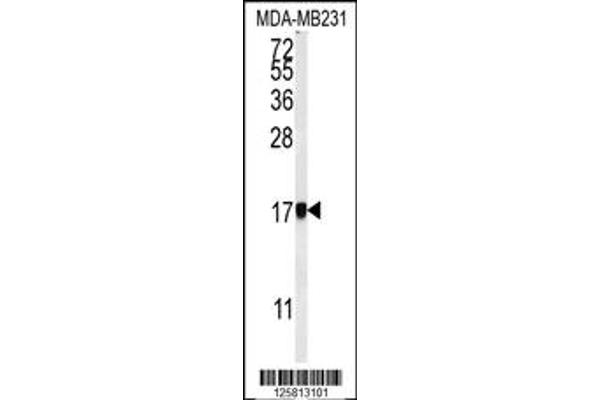 anti-Adaptor Related Protein Complex 1 sigma 1 (AP1S1) (N-Term) antibody