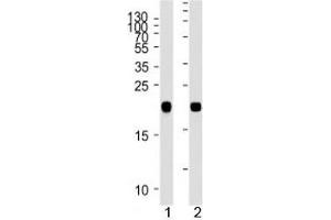 Image no. 1 for anti-GTPase NRas (NRAS) (AA 70-101) antibody (ABIN3028691)