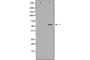 Image no. 1 for anti-Autoimmune Regulator (AIRE) (Internal Region) antibody (ABIN6266320)