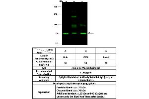 Image no. 1 for anti-Sex Comb On Midleg-Like 2 (SCML2) (N-Term) antibody (ABIN6925335)