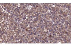 Image no. 3 for anti-Adrenergic, Beta, Receptor Kinase 1 (ADRBK1) antibody (ABIN6259807)