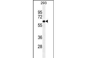 PATL2 antibody  (AA 168-196)