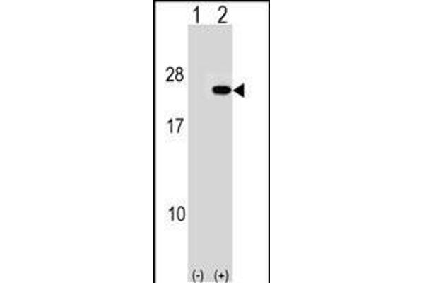PAIP2 抗体  (N-Term)