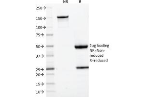 Image no. 7 for anti-CD22 Molecule (CD22) (AA 52-178) antibody (ABIN6941120)
