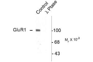 anti-Glutamate Receptor 1 (GLUR1) (pSer845) antibody