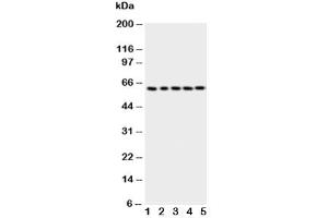 Image no. 5 for anti-T-Complex 1 (TCP1) (AA 82-98) antibody (ABIN3029087)