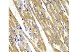 Immunohistochemistry of paraffin-embedded Rat heart using TYR Polyclonal Antibody at dilution of 1:100 (40x lens).