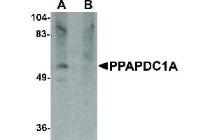 Image no. 1 for anti-Phosphatidic Acid Phosphatase Type 2 Domain Containing 1A (PPAPDC1A) (C-Term) antibody (ABIN6656900)
