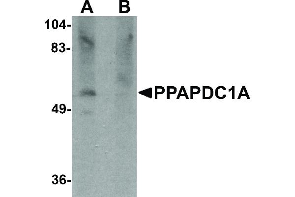 anti-Phosphatidic Acid Phosphatase Type 2 Domain Containing 1A (PPAPDC1A) (C-Term) antibody