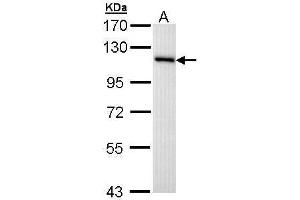 Image no. 1 for anti-Minichromosome Maintenance Complex Component 3 (MCM3) (Center) antibody (ABIN2856791)
