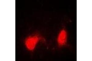Image no. 1 for anti-Sjogren Syndrome Nuclear Autoantigen 1 (SSNA1) antibody (ABIN2967064)