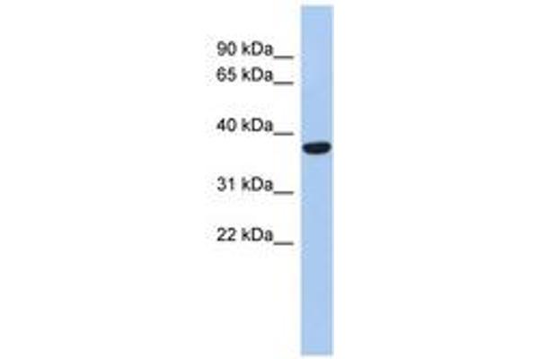 PPAPDC2 Antikörper  (N-Term)