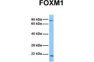 Image no. 4 for anti-Forkhead Box M1 (FOXM1) (Middle Region) antibody (ABIN2792172)