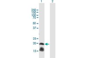 Western Blot analysis of IL1RN expression in transfected 293T cell line by IL1RN MaxPab polyclonal antibody.