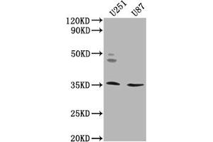 OR5K2 antibody  (AA 6-24)