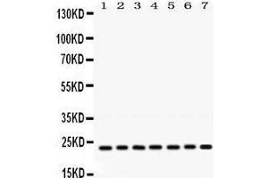 Image no. 1 for anti-V-Ral Simian Leukemia Viral Oncogene Homolog B (Ras Related, GTP Binding Protein) (Ralb) (AA 166-203), (C-Term) antibody (ABIN3043919)