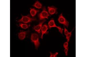 Image no. 2 for anti-Protein Kinase A, alpha (PRKACA) (Internal Region) antibody (ABIN6264236)