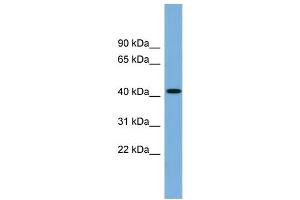 Image no. 1 for anti-WD Repeat and FYVE Domain Containing 1 (WDFY1) (N-Term) antibody (ABIN2787237)