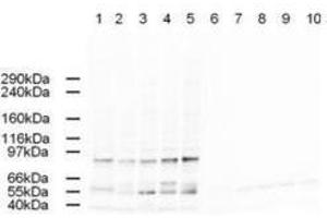 Western blot using  Affinity Purified anti-AP2A antibody shows detection of a band just below 100 kDa correspond-ing to Human AP2A1 in a various preparations.