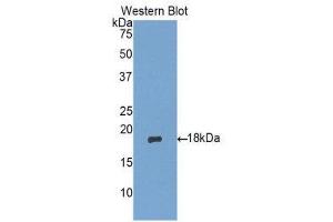 Image no. 1 for anti-Matrix Gla Protein (MGP) (AA 20-103) antibody (ABIN1174666)