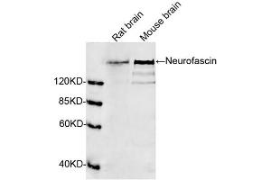 Image no. 1 for anti-Neurofascin (NFASC) (N-Term) antibody (ABIN1574089)