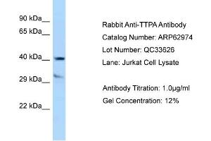 Image no. 1 for anti-Tocopherol (Alpha) Transfer Protein (TTPA) (C-Term) antibody (ABIN2789318)