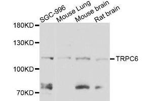 TRPC6 抗体  (AA 500-600)