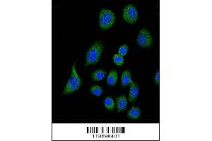 Image no. 3 for anti-Complement Factor H (CFH) (AA 751-780) antibody (ABIN654896)
