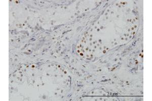 Image no. 5 for anti-Bromodomain Containing 3 (BRD3) (AA 418-556) antibody (ABIN563516)