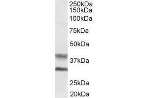Image no. 1 for anti-Asporin (ASPN) (Internal Region) antibody (ABIN185364)