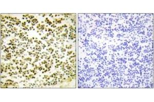 Immunohistochemistry analysis of paraffin-embedded human lymph node, using RBL1 (Phospho-Thr369) Antibody.